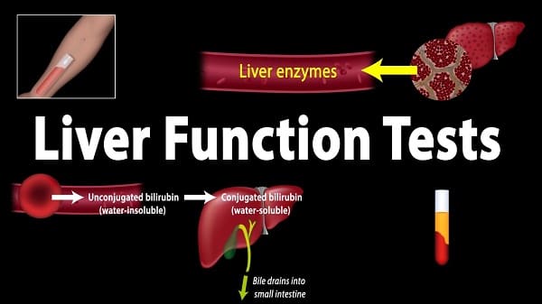 liver function test