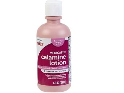 Calamine Lotion