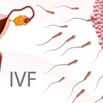 ivf